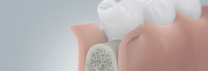 implantation_setzten1